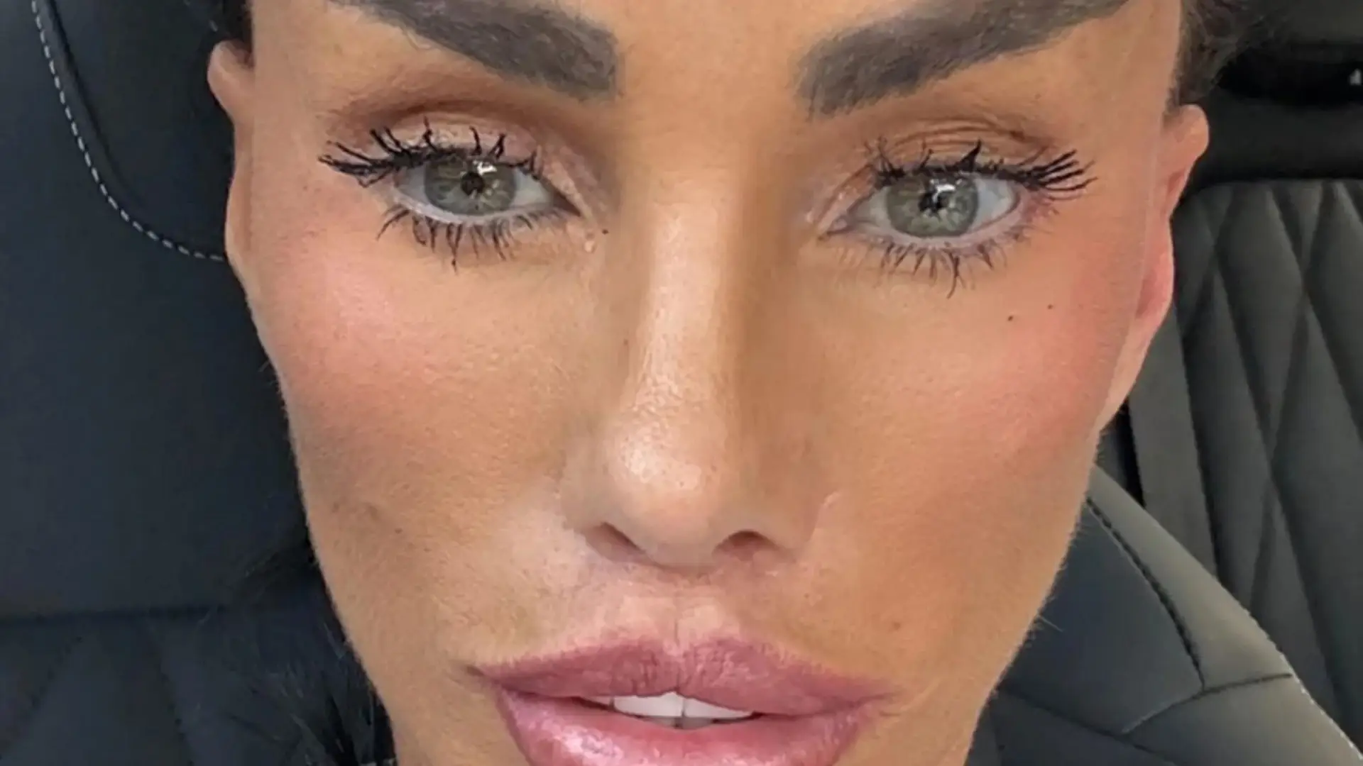 The Stitches Have a Voice: Katie Price and the Glorious, Self-Inflicted Melodrama of Modern Celebrity